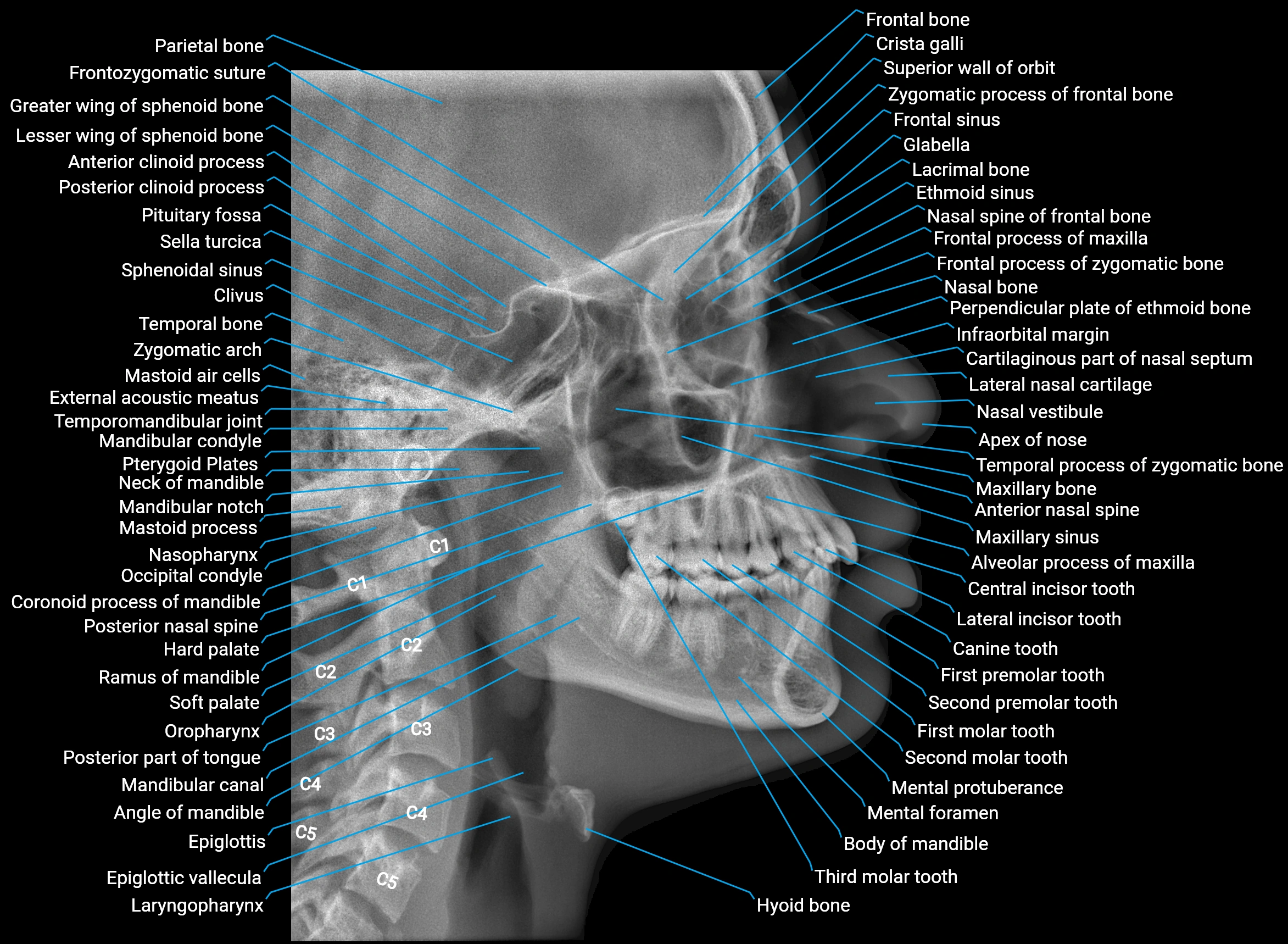 cephalogram x ray anatomy image final.webp